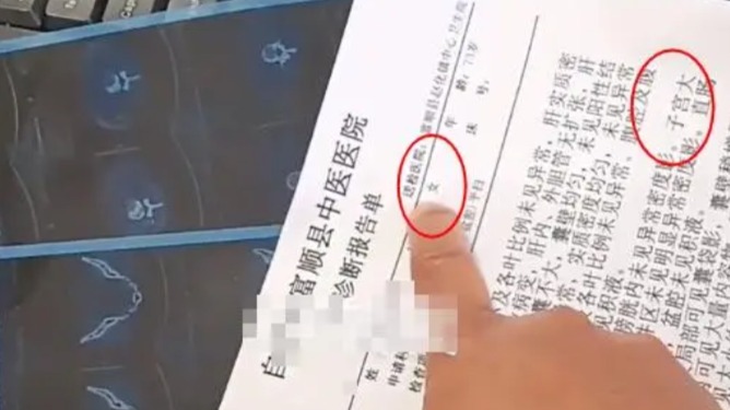 自贡一七旬男子CT报告出现子宫？官方最新回应