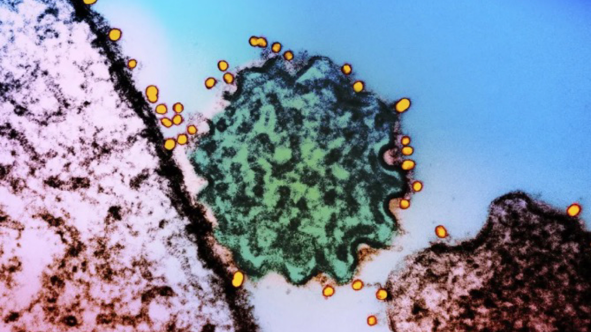 “致命尼帕”会全球流行吗？该如何防护？