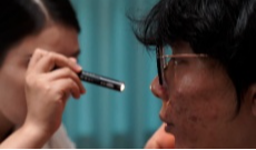 过了青春期竟还在长痘 应该怎么办？