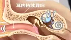 1月13日养老全接触