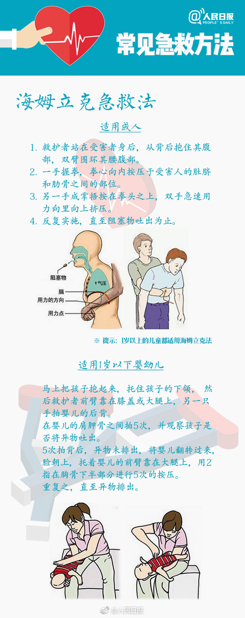 海姆立克急救法.jpeg