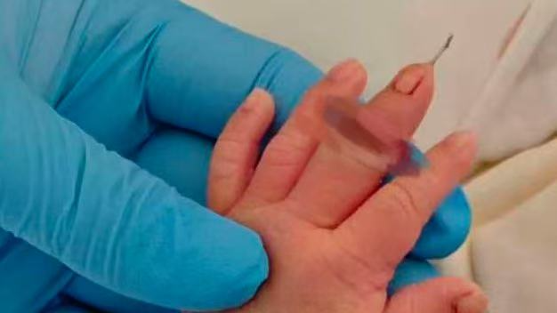 江苏盱眙通报“新生儿手指被剪断”事件：患儿已手术，当事助产士已停职