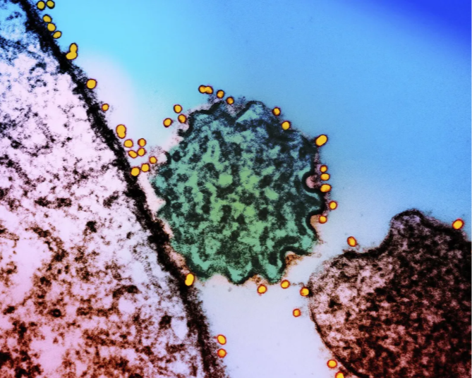 尼帕病毒怎样传播？如何提早预防？一文了解