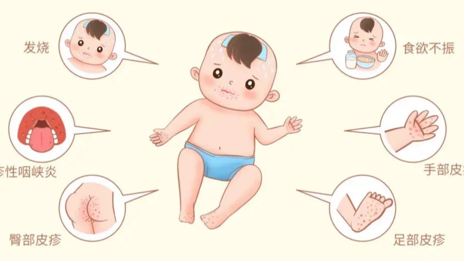 @家长们！幼儿手足口病预防知识请查收