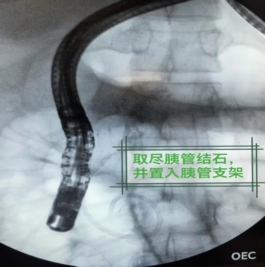 dd7cba3bc4782efed278ed0c02c3521b.png dd7cba3bc4782efed278ed0c02c3521b.png